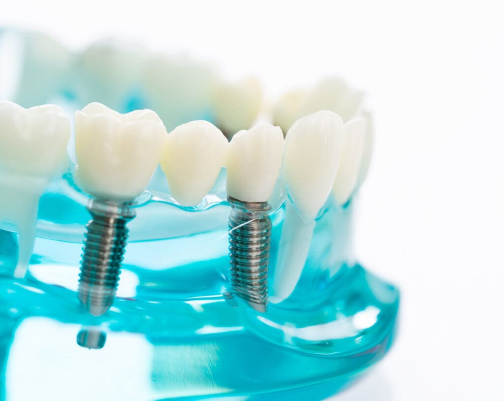 Same Day Smile Skokie IL