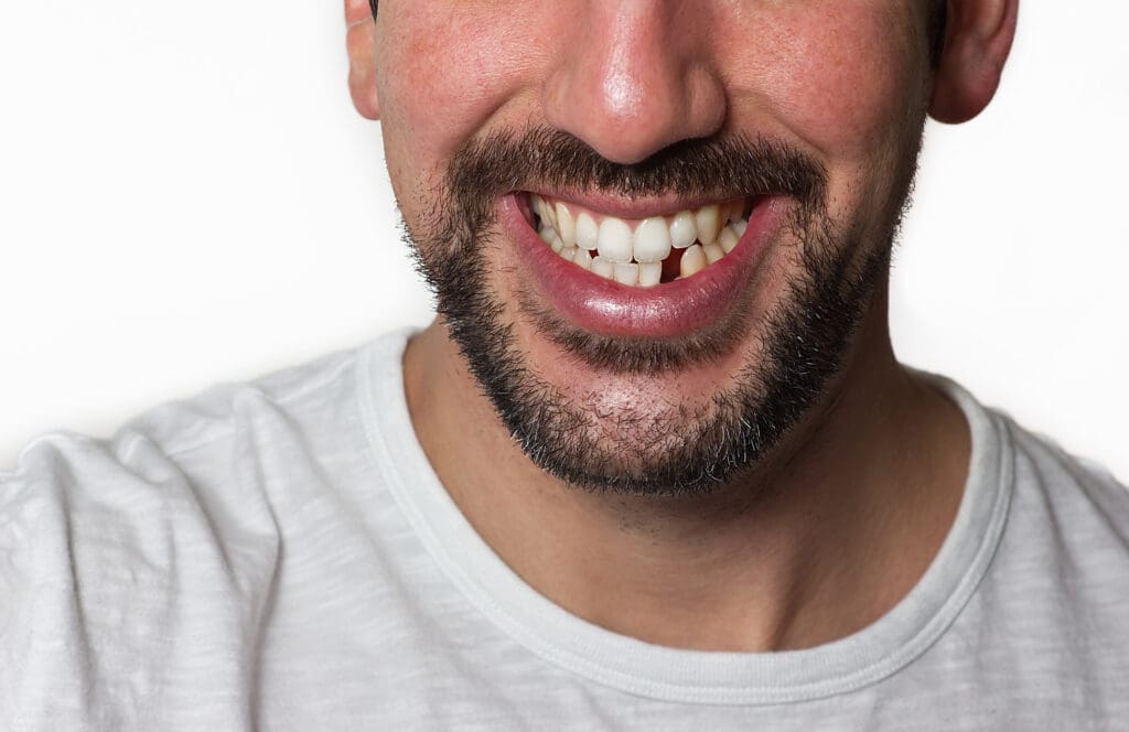 Replace Missing Teeth in Skokie IL