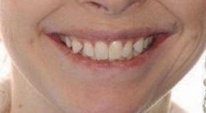Before Dental Collaboration